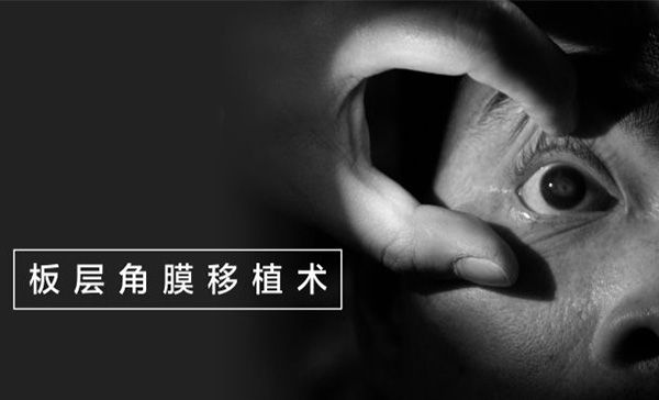 角膜内皮移植手术的优势有哪些？